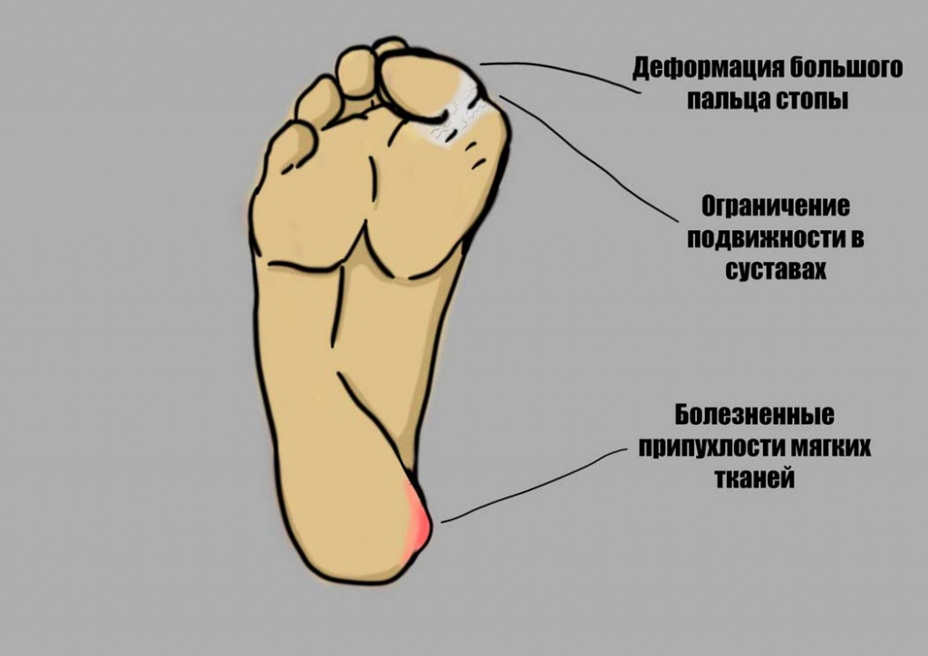 Признаки ФОП.jpg Признаки ФОП.jpg