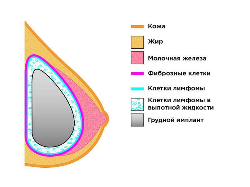 Grud_rus.jpg Grud_rus.jpg