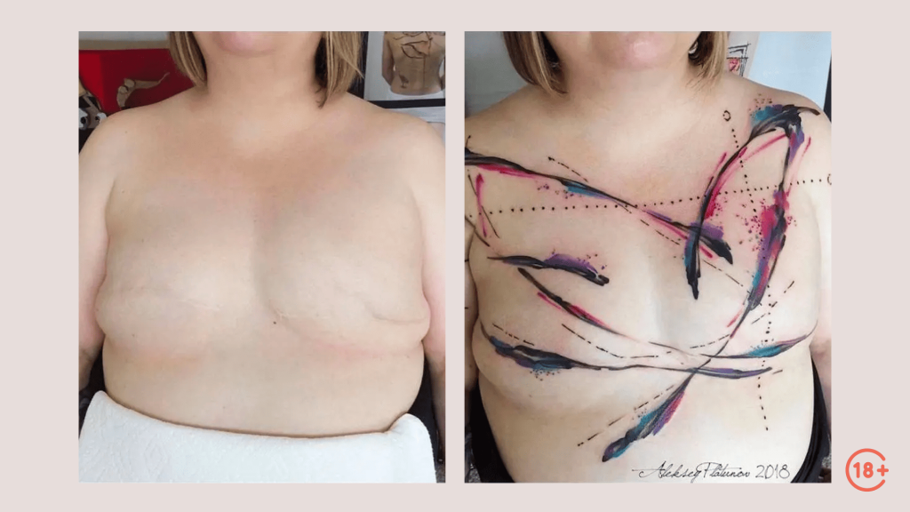 Татуировка поверх шрамов после удаления молочных желез.png Татуировка поверх шрамов после удаления молочных желез.png