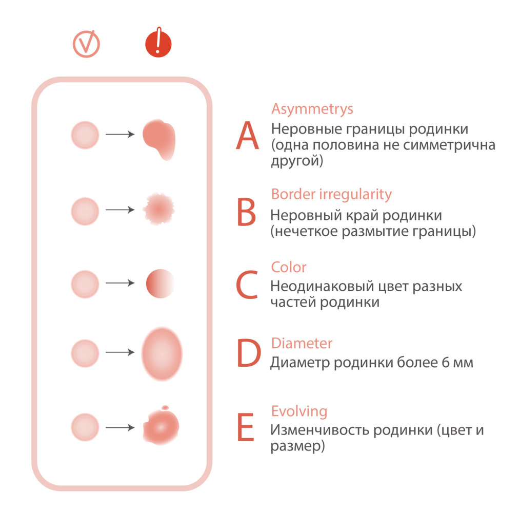 Симтомы меланомы.jpg Симтомы меланомы.jpg