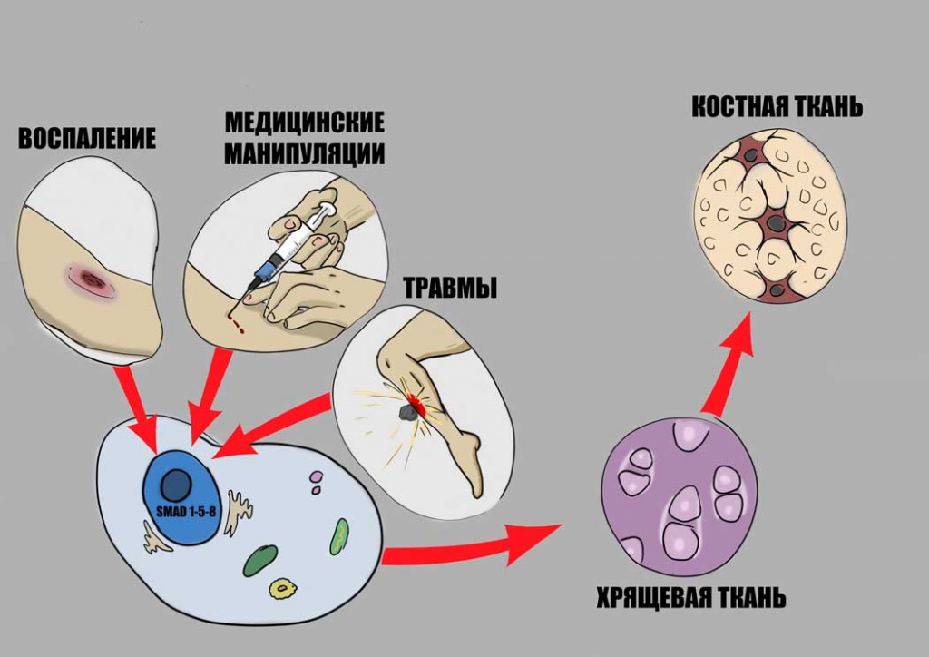 Опасные манипуляции при ФОП.jpg