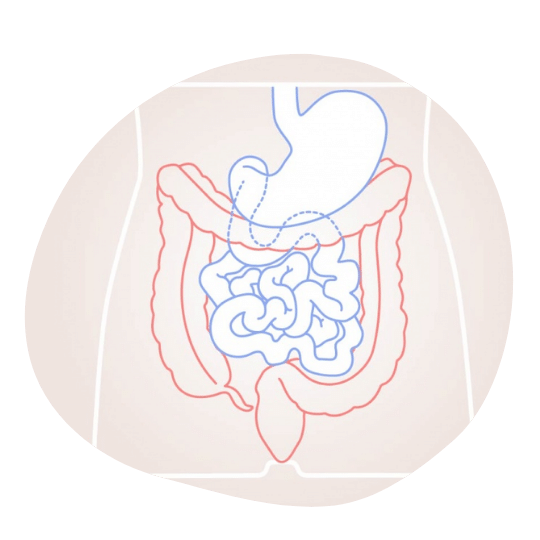 Что вы знаете о раке кишечника.png