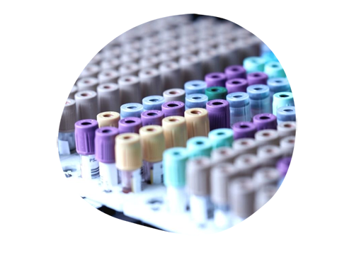 Анализ кала на скрытую кровь.png