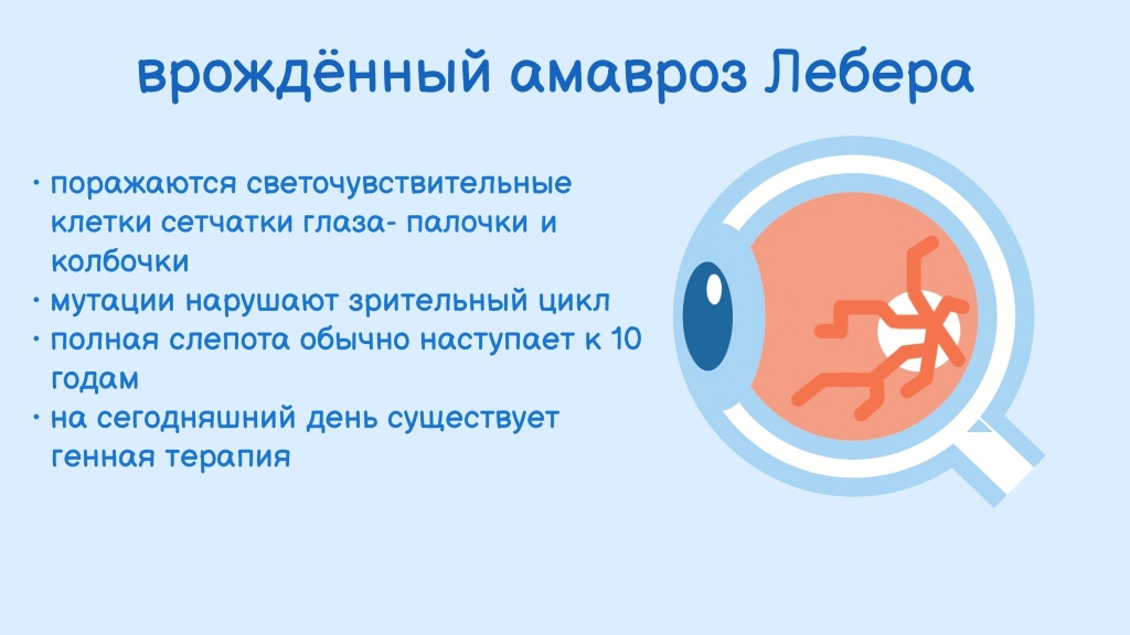 Врожденный Амавроз Лебера Врожденный Амавроз Лебера