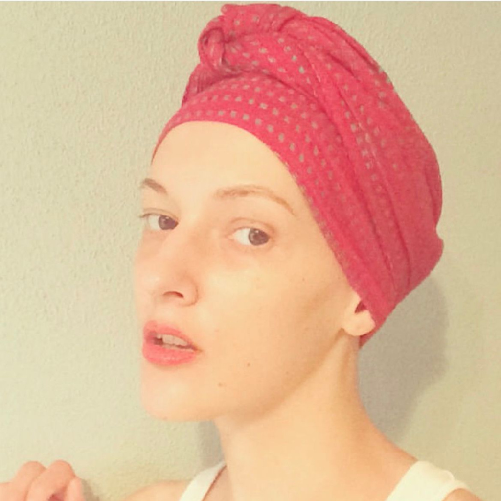 После трансплантации.jpeg