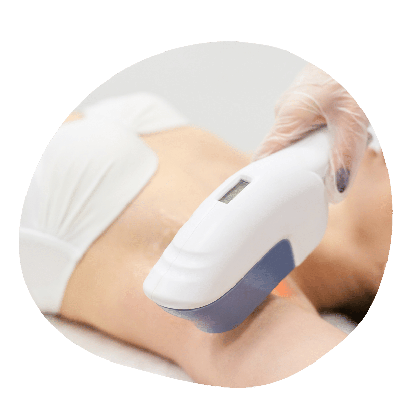 Лазерный эпилятор.png Лазерный эпилятор.png