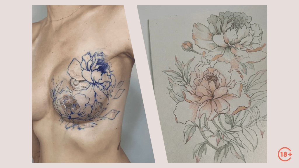 Восстановление соска и ареолы.jpeg Восстановление соска и ареолы.jpeg