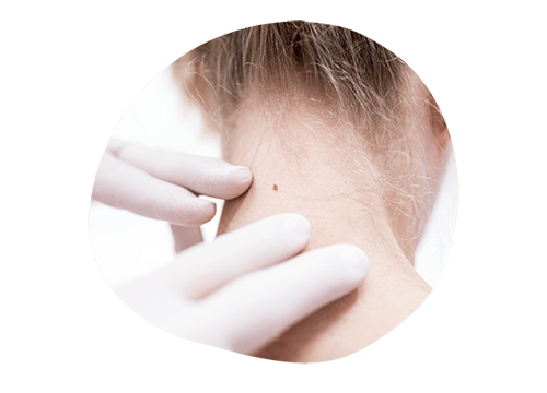 Осмотр кожи.png