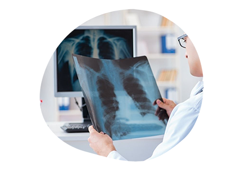 Рак легкого.png