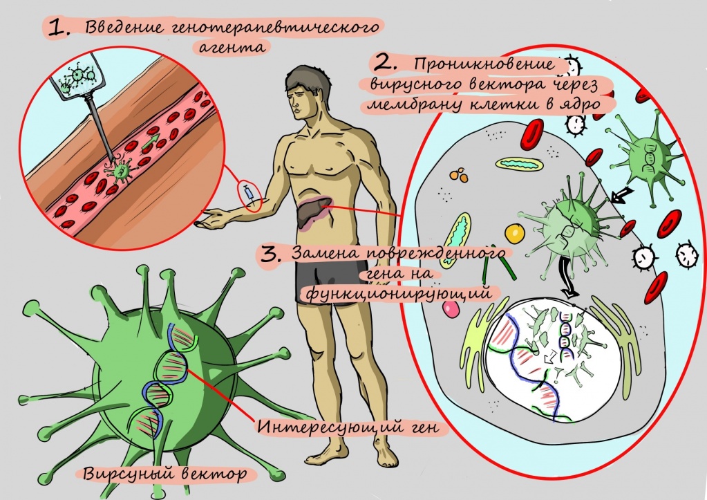 Болезнь Вильсона-Коновалова...jpg