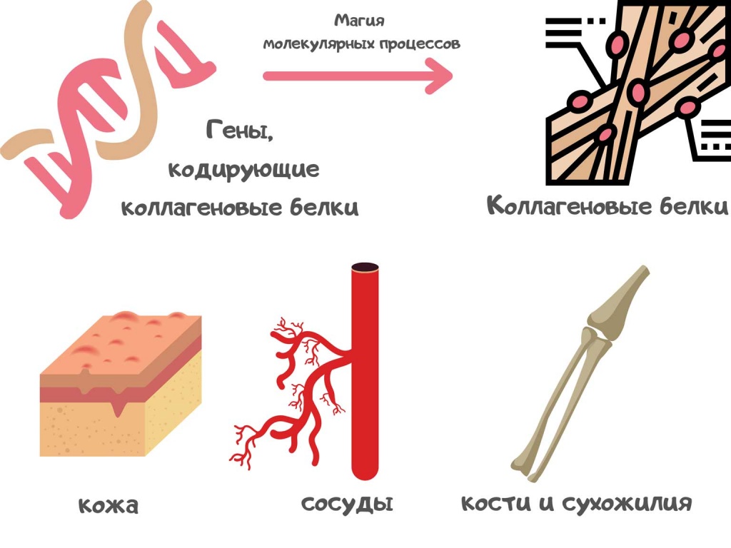 Синдром Элерса-Данло.jpg