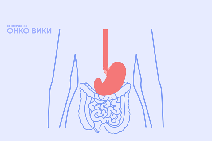 «Правильное питание и отказ от курения снижают риск заболеть»: вышел справочник о раке желудка