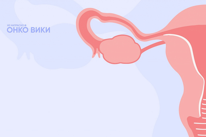 «Опухоль может быть случайной находкой»: вышел онлайн-справочник о раке яичника