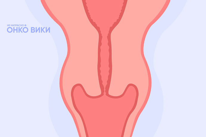 «Есть надежда, что эта болезнь будет побеждена»: вышел онлайн-справочник о раке шейки матки