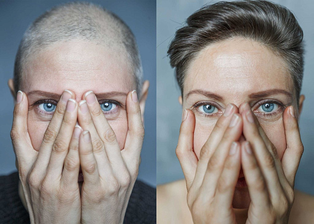 «Не бойся, я это прошла». Как равные консультанты помогают людям с онкозаболеваниями