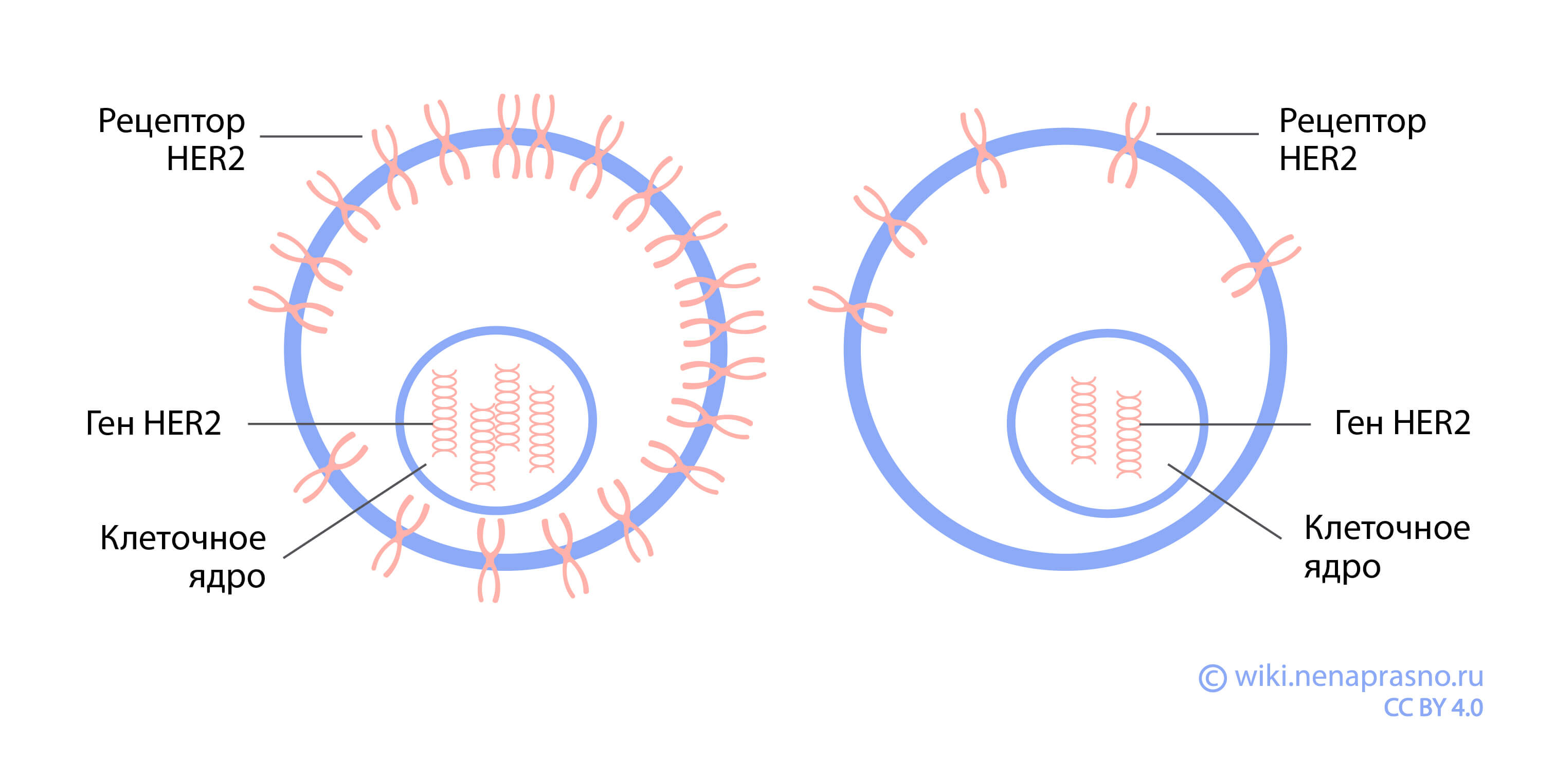 Особенности лечения HER2-позитивного рака молочной железы