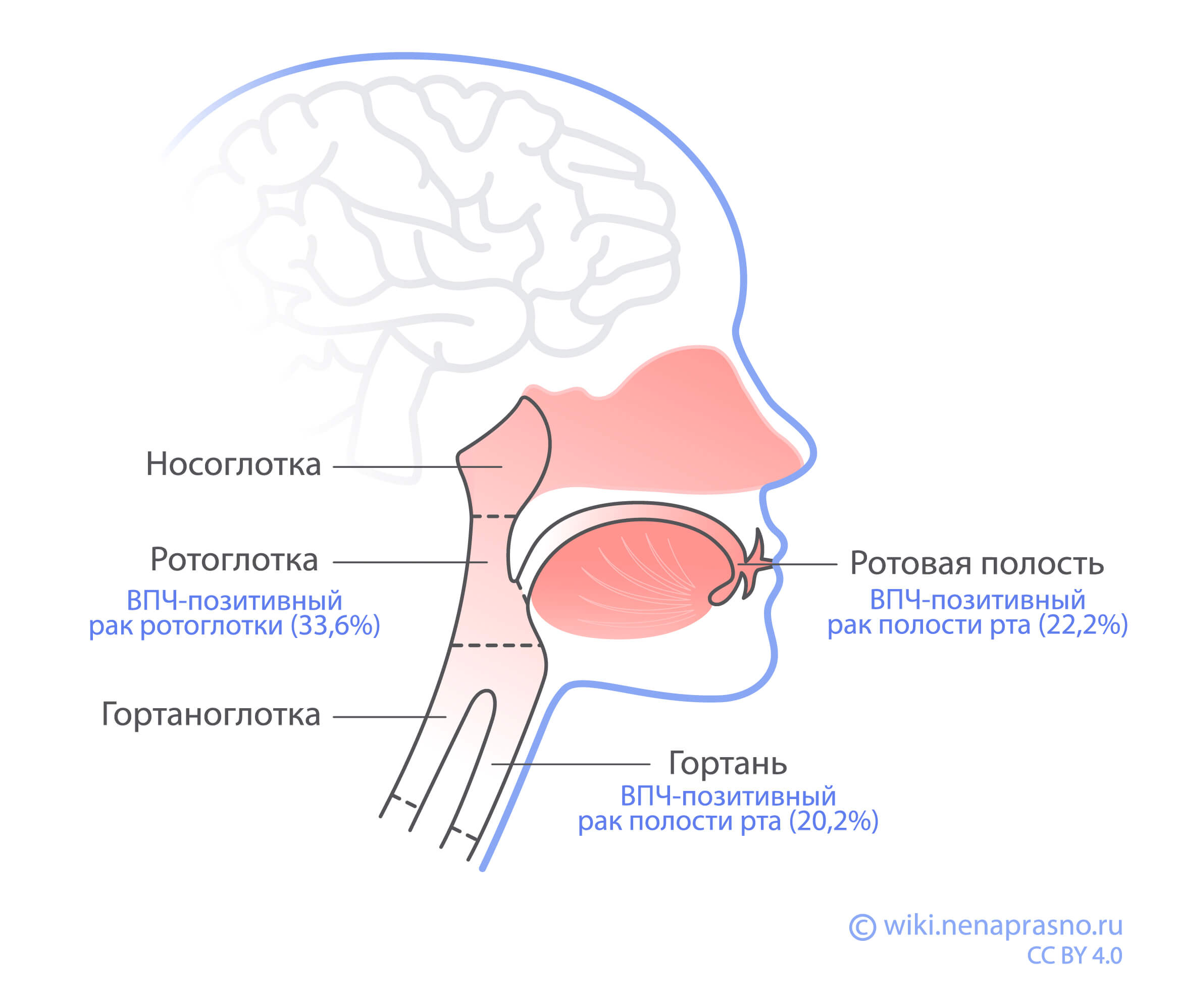 Опухоли головы и шеи и ВПЧ.jpg Опухоли головы и шеи и ВПЧ.jpg