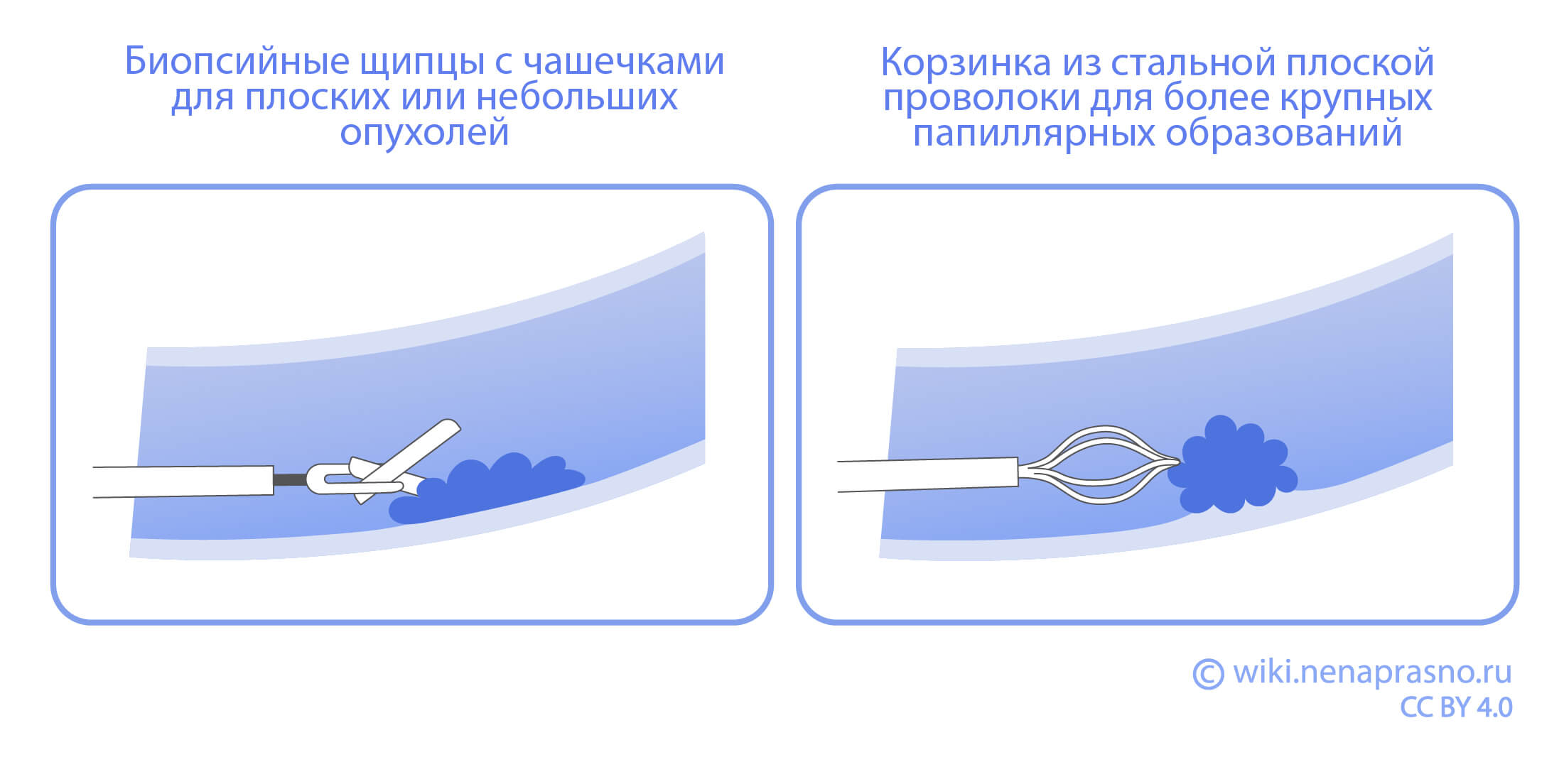 Биопсийные щипцы - корзинка.jpg Биопсийные щипцы - корзинка.jpg